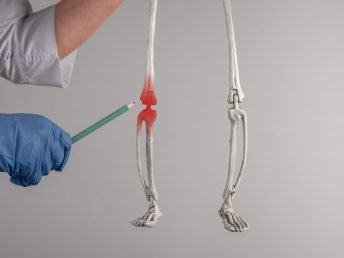 Doctor hand pointing to skeleton knee with red spot. Leg pain. Arthritis, infection, gout, ruptured ligaments, torn cartilage. Skeletal system anatomy, body structure, medical education. photo